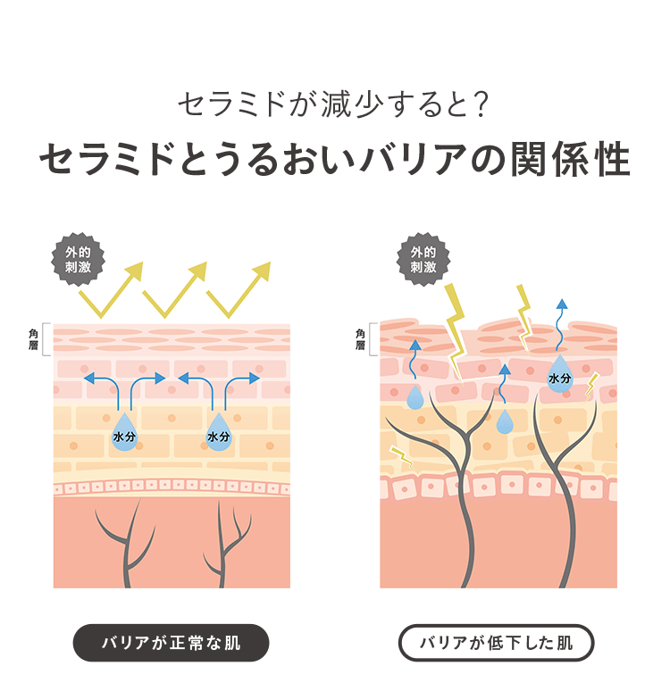 セラミドが減少すると? セラミドとうるおいバリアの関係性